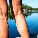 The Benefits of a Comprehensive Vein Center Approach