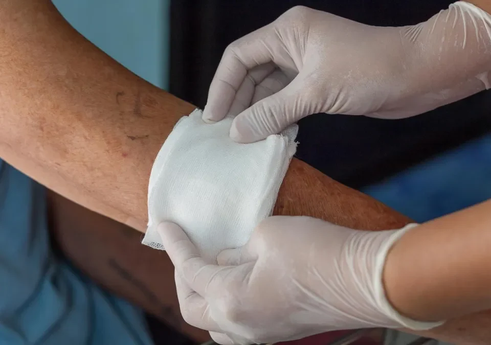 Effective Strategies for Managing Chronic Wounds