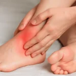 Managing Pain and Discomfort After an Ankle Sprain