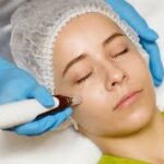 The Benefits of Combining Microneedling With Other Treatments