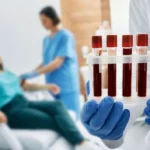 The Importance of Early Detection in Brain Cancer Treatment Success