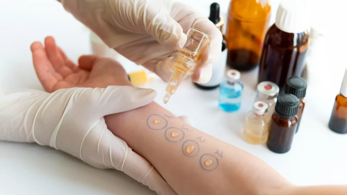 The Role of Allergy Testing in Personalized Treatment Plans