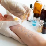 The Role of Allergy Testing in Personalized Treatment Plans