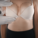 Debunking Myths About Breast Exams