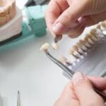 Questions To Ask Your Dentist About Porcelain Veneers
