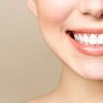 Understanding the Cost of Veneers