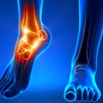 Alternative Therapies for Peripheral Neuropathy Relief