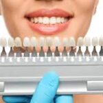 Exploring Available Cosmetic Dentistry Options