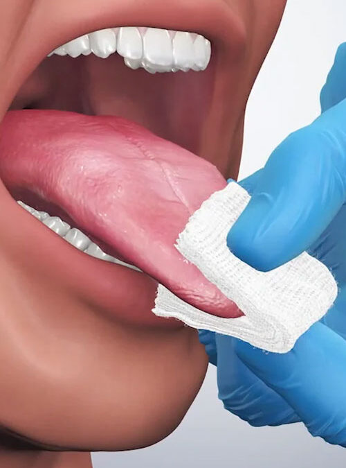 Exploring the Role of Pap Smears in Preventive Care