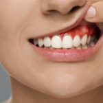 Exploring the Role of Periodontal Treatments for Gum Health