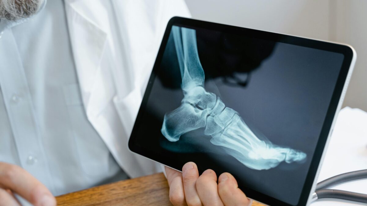 Frequently Asked Questions About Ankle Replacement