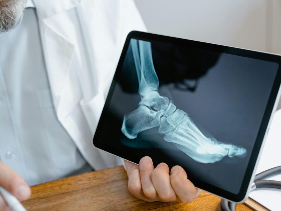 Frequently Asked Questions About Ankle Replacement