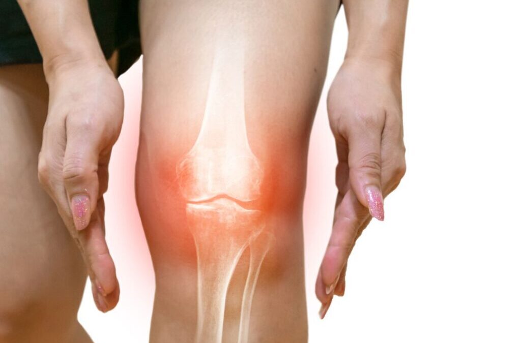 Navigating Recovery After a Sports Injury
