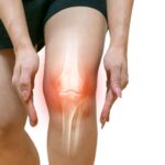 Navigating Recovery After a Sports Injury