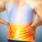Recognizing Sciatica Symptoms