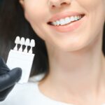 Recovery Process After Getting Veneers