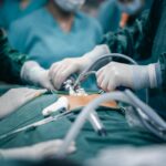 The Benefits of Robotic Hysterectomy