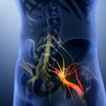 The Connection Between Sciatica and Herniated Discs