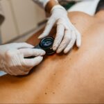 The Importance of Regular Check-Ups for Mohs Surgery Patients