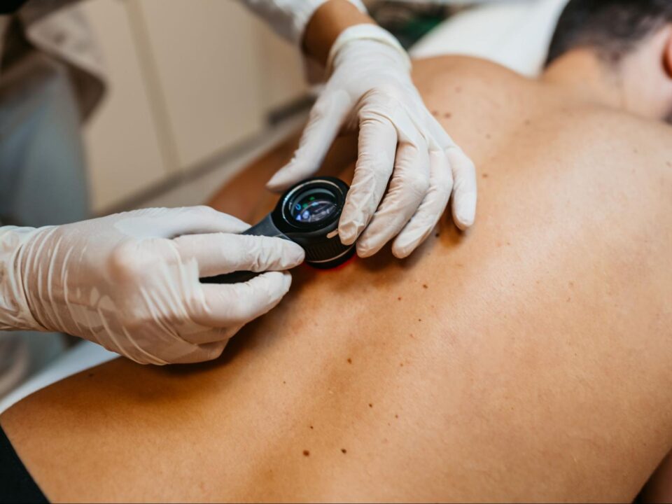 The Importance of Regular Check-Ups for Mohs Surgery Patients