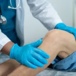 The Key Role of Orthopedic Surgeons in Joint Replacement Surgery