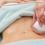 Tips for Tailoring Your Body Contouring Experience