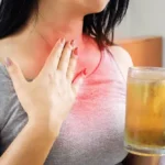 Understanding Acid Reflux Triggers
