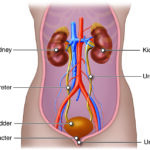 Understanding the Benefits and Drawbacks of a Vasectomy