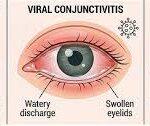 What To Know About Effective Treatments for Pink Eye