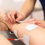 What You Need To Know Before Starting Electro Shock Therapy