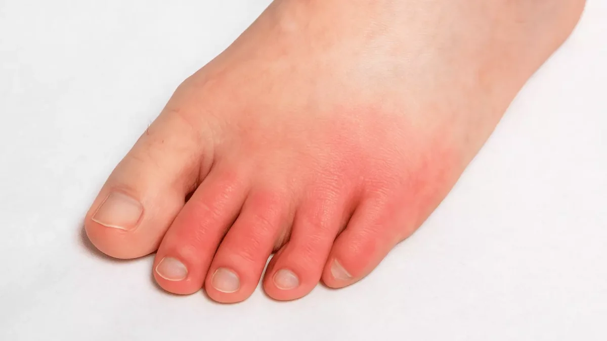 When Leg Pain May Signal a More Serious Issue