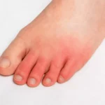 When Leg Pain May Signal a More Serious Issue