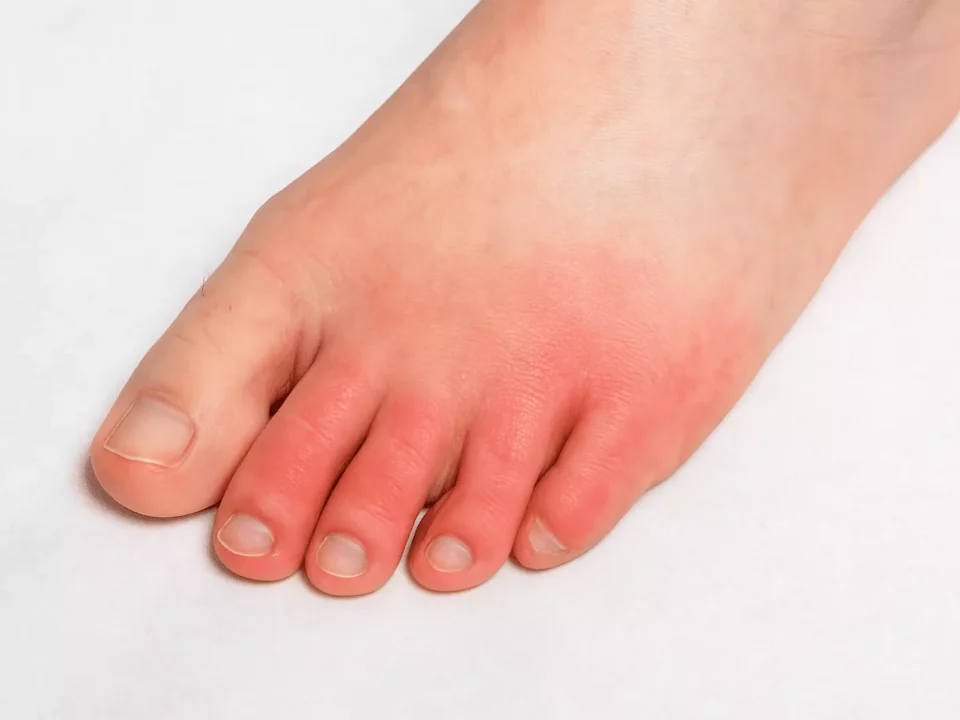 When Leg Pain May Signal a More Serious Issue