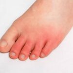 When to See a Podiatrist for Common Foot Problems